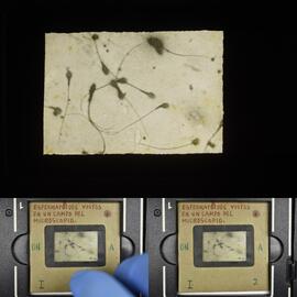 Espermatozoides vistos en el campo del microscopio
